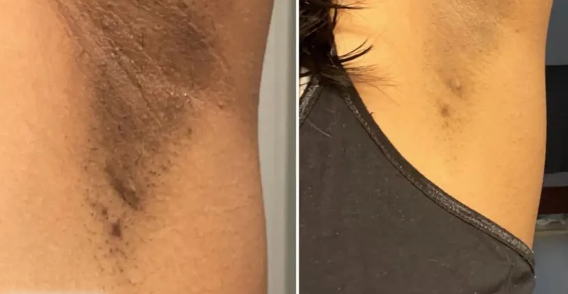 Hand Made Kojic Acid Dark Spot Remover Soap