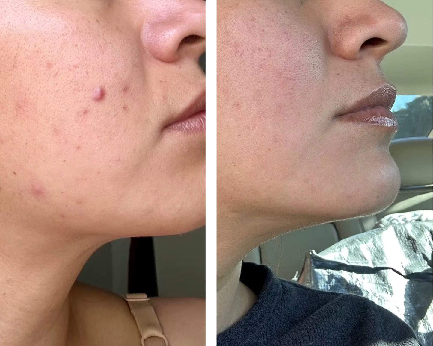 Hand Made Kojic Acid Dark Spot Remover Soap