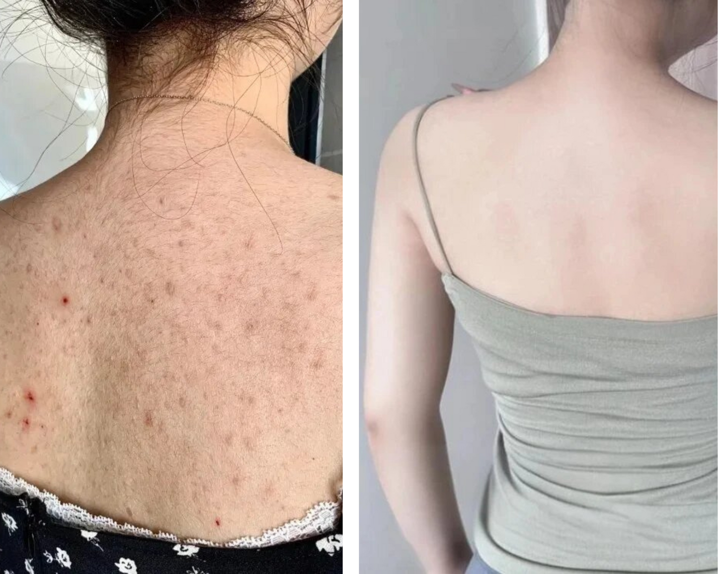 Hand Made Kojic Acid Dark Spot Remover Soap