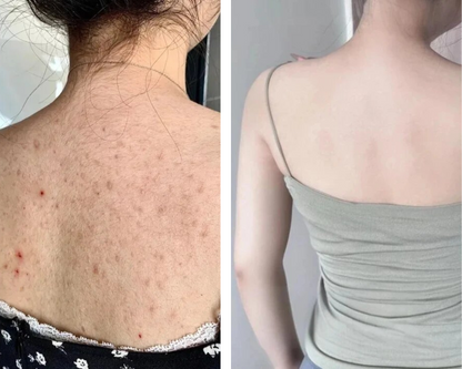 Hand Made Kojic Acid Dark Spot Remover Soap