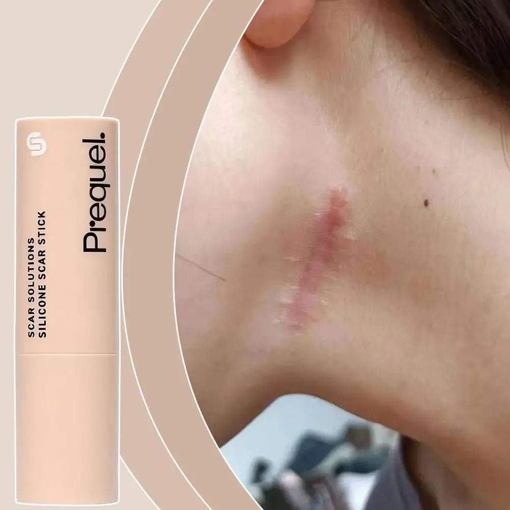 Silicone Scar, Acne & Wrinkle Solution Stick