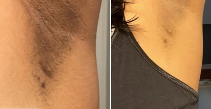 Hand Made Kojic Acid Dark Spot Remover Soap